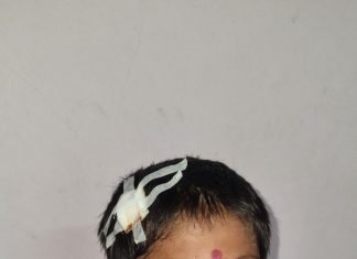 शिक्षकातला राक्षस जागा झाला लघूशंकेला उशीर झाला म्हणून सातवीच्या विद्यार्थ्यांचे डोके फोडले